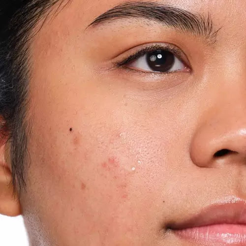 Why SPF 50+ Should Be Your Skincare Non-Negotiable