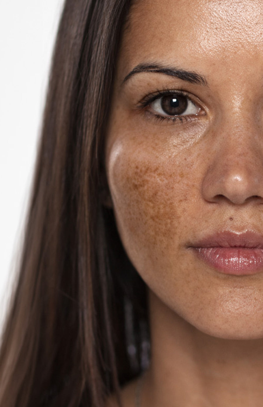 Pigmentation